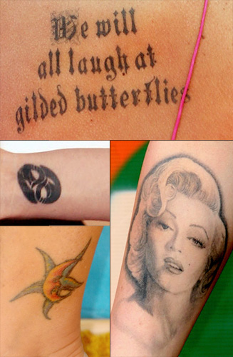  tattoo removal of the Marilyn Monroe portrait on her right forearm